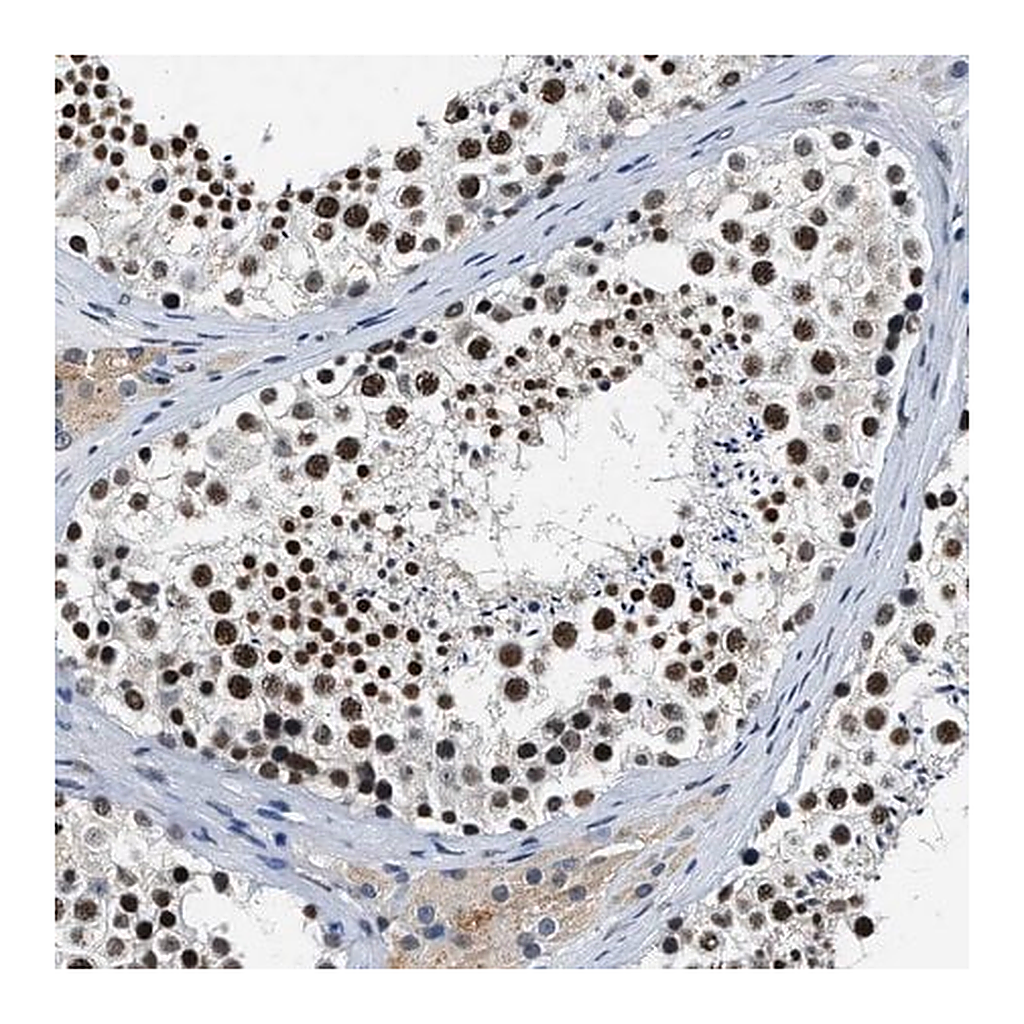 Merck Anti-CCNE1 antibody produced in rabbit