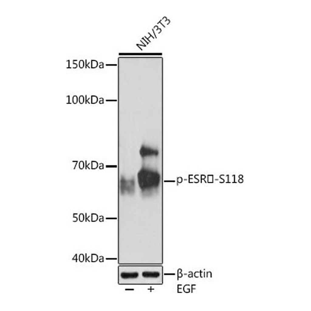 Merck Anti-Phospho-ESRalpha-S118 antibody produced in rabbit