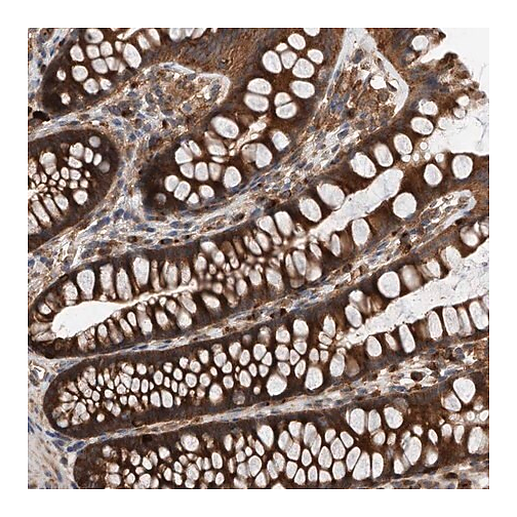 Merck Anti-C21orf2 antibody produced in rabbit