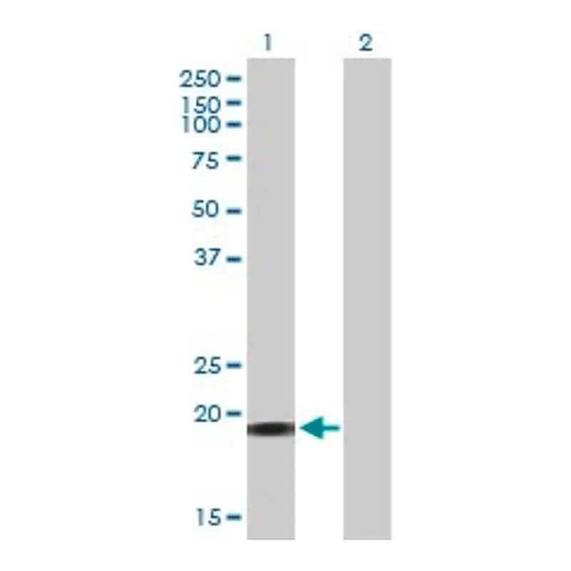Merck Anti-YSK4 antibody produced in mouse