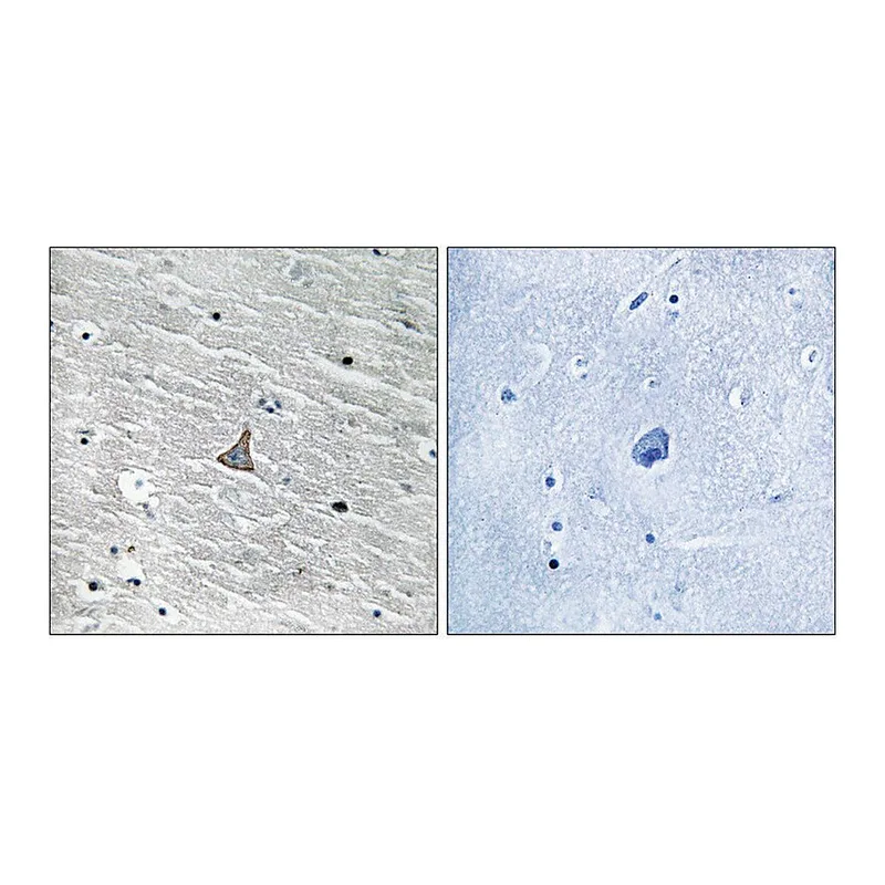 Merck Anti-VHL antibody produced in rabbit