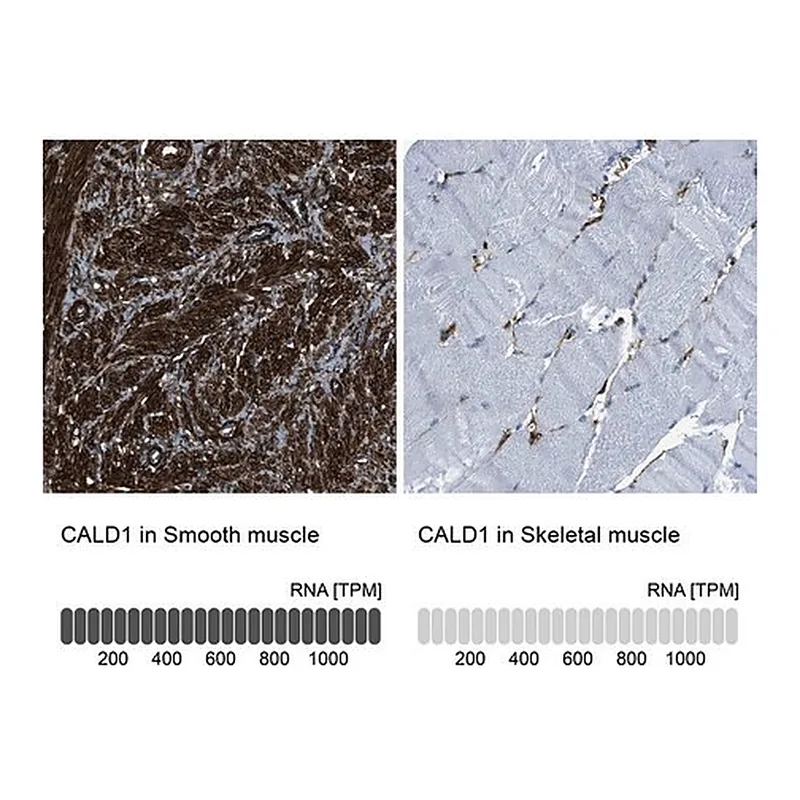 Merck Anti-CALD1 antibody produced in rabbit