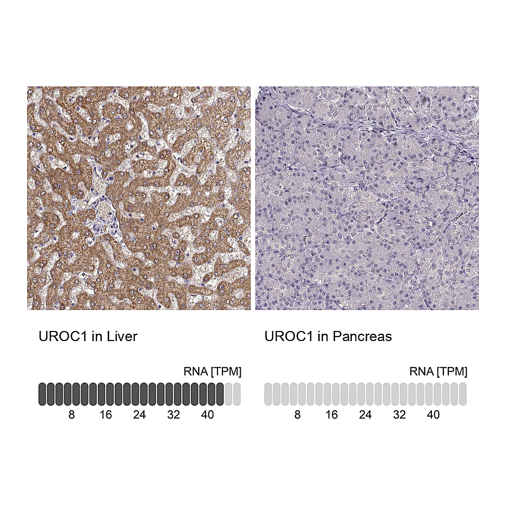 Atlas Antibodies Anti-UROC1 Antibody