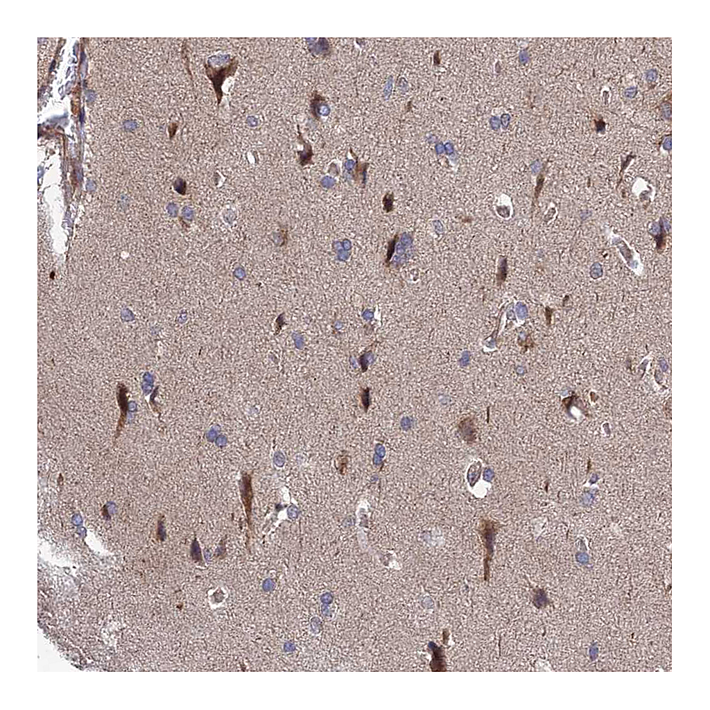 Atlas Antibodies Anti-UROS Antibody