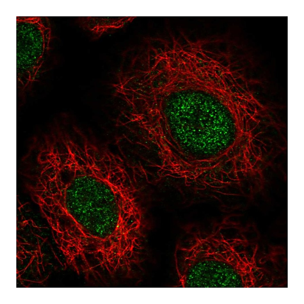 Atlas Antibodies Anti-USB1 Antibody