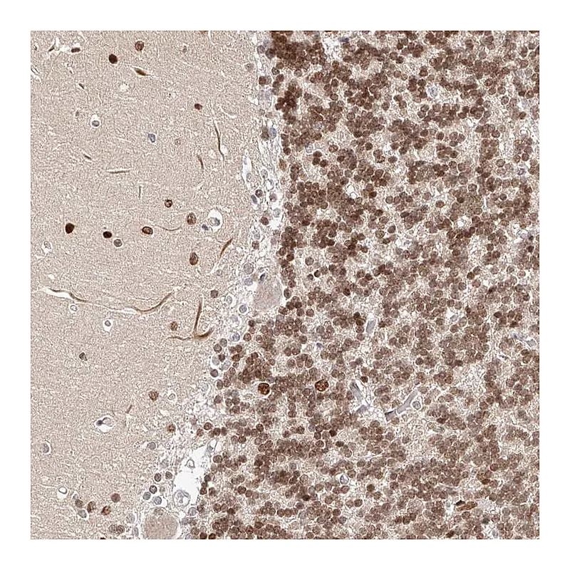 Atlas Antibodies Anti-USF3 Antibody