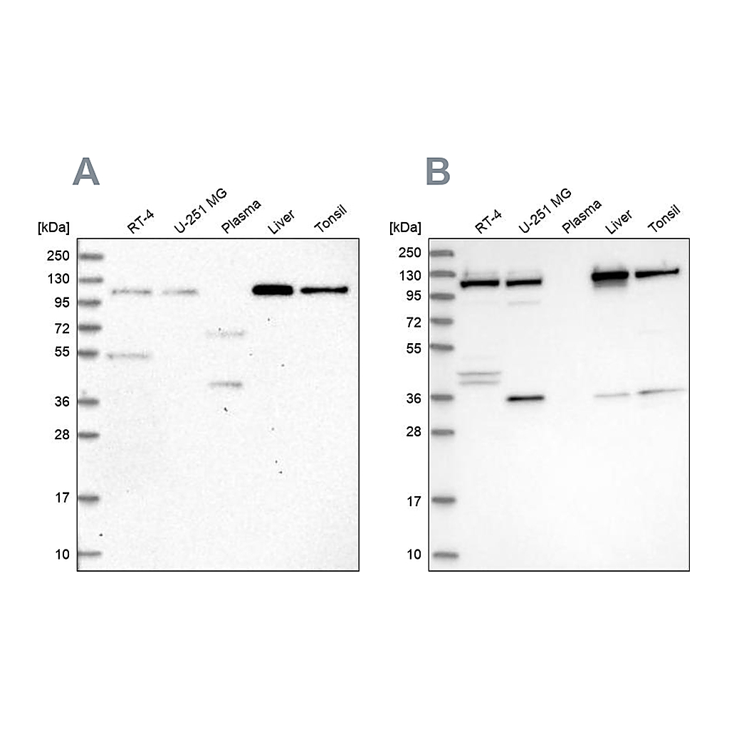 Atlas Antibodies Anti-USO1 Antibody