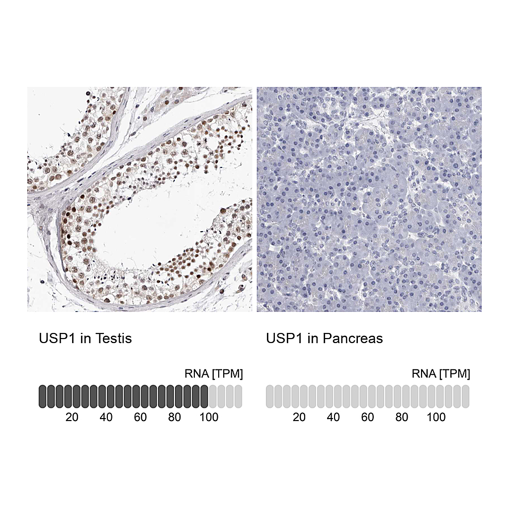 Atlas Antibodies Anti-USP1 Antibody