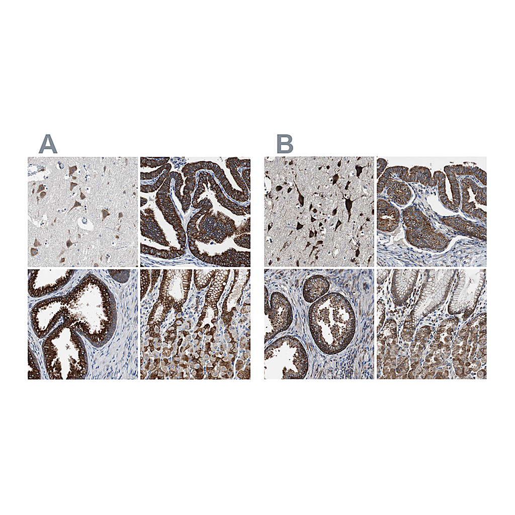 Atlas Antibodies Anti-USP10 Antibody
