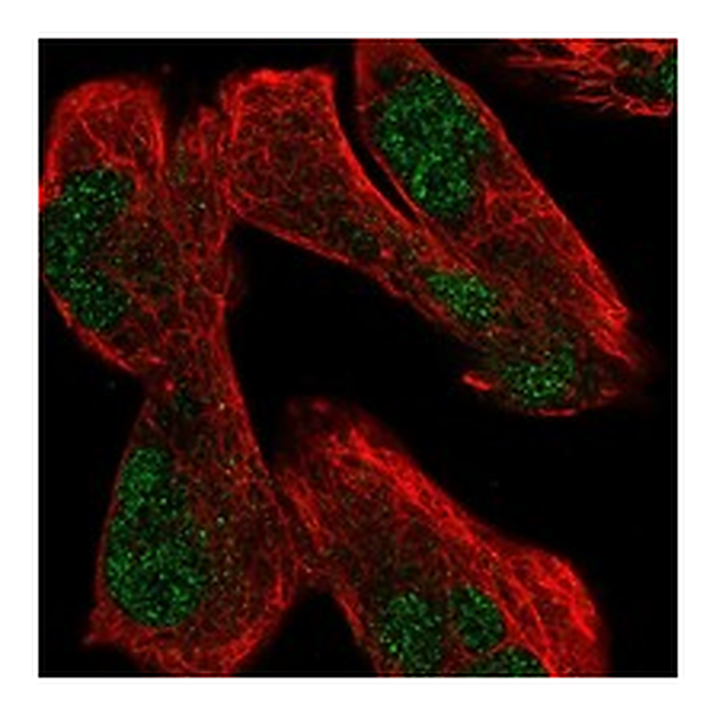Atlas Antibodies Anti-USP12 Antibody