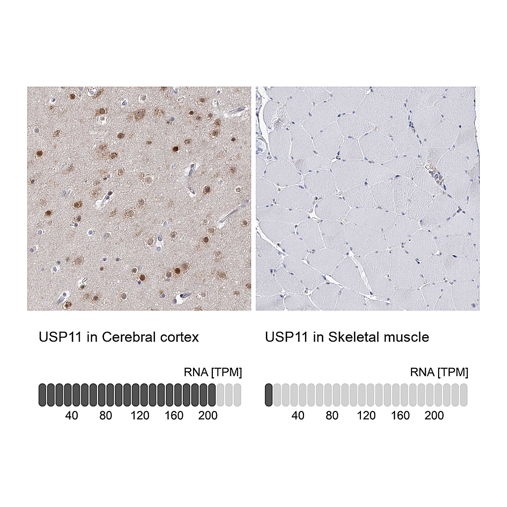 Atlas Antibodies Anti-USP11 Antibody