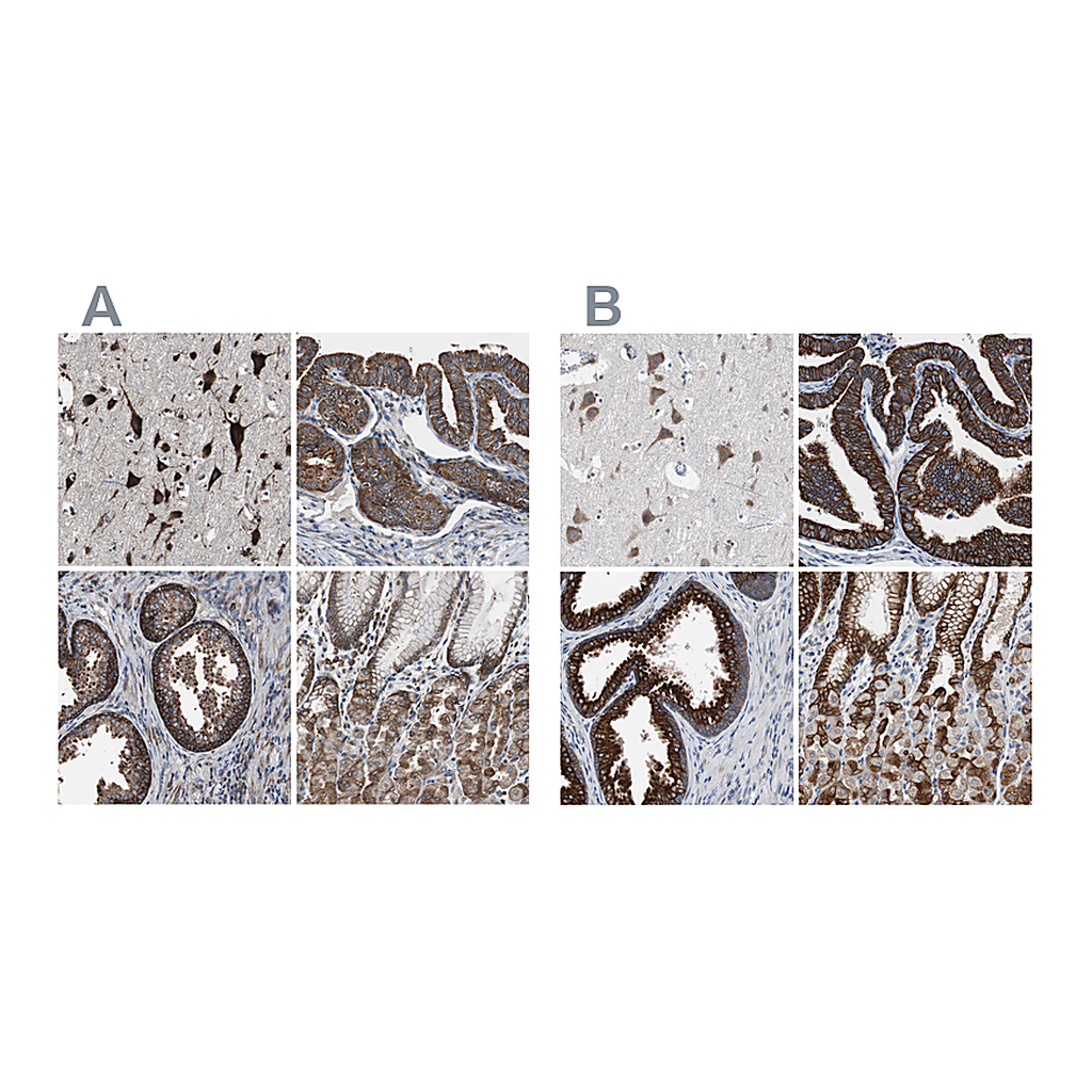 Atlas Antibodies Anti-USP10 Antibody