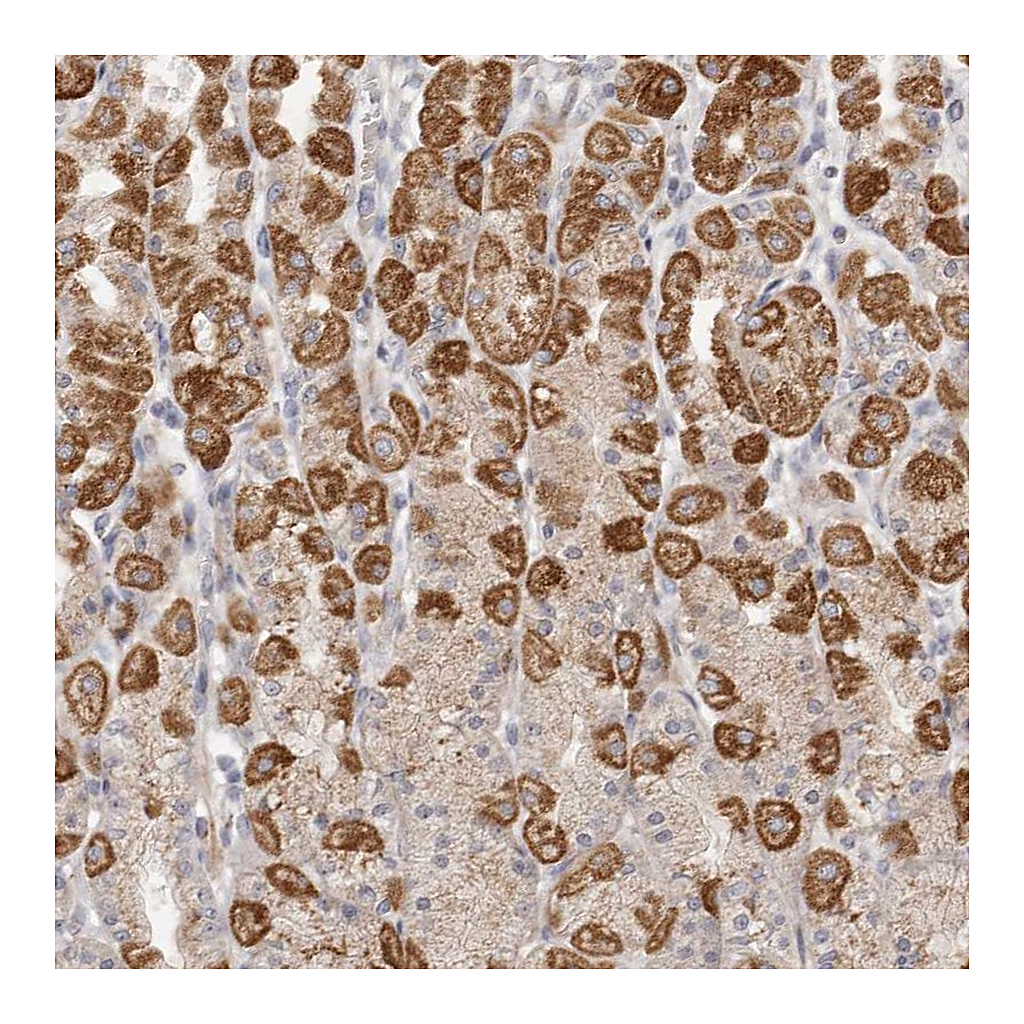 Atlas Antibodies Anti-USP24 Antibody