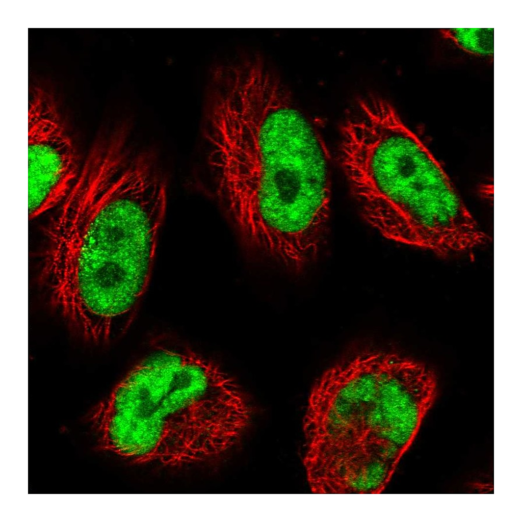 Atlas Antibodies Anti-USP22 Antibody