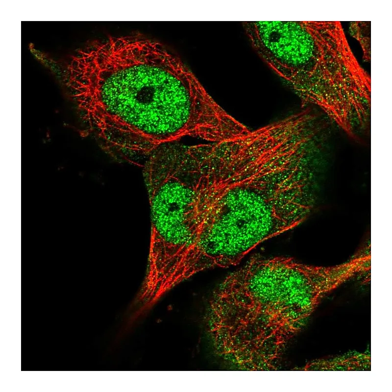 Atlas Antibodies Anti-USP24 Antibody