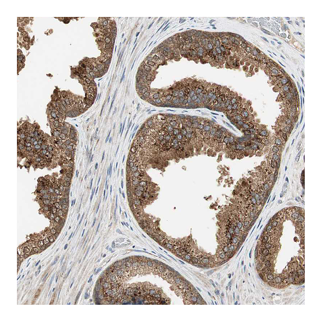 Atlas Antibodies Anti-USP2 Antibody