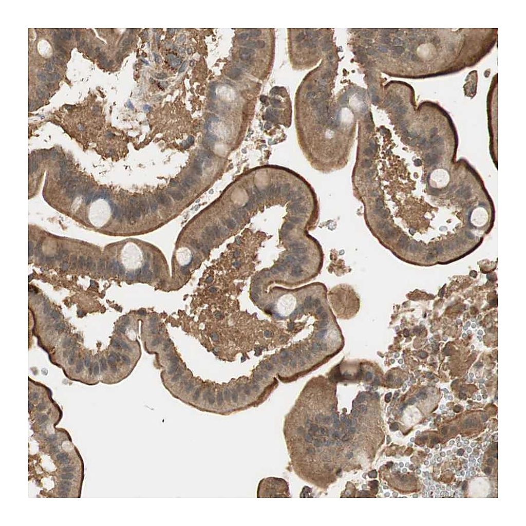 Atlas Antibodies Anti-USP2 Antibody