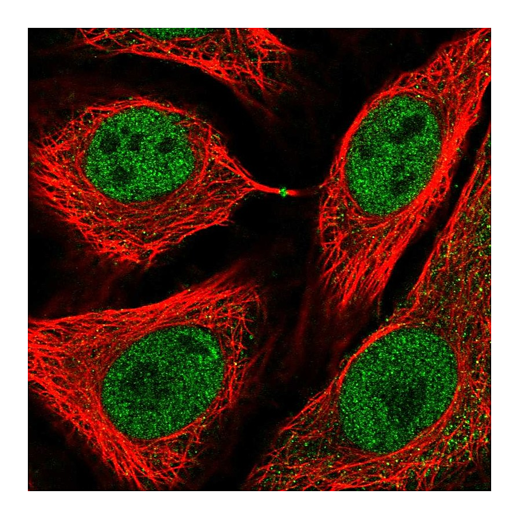 Atlas Antibodies Anti-USP3 Antibody