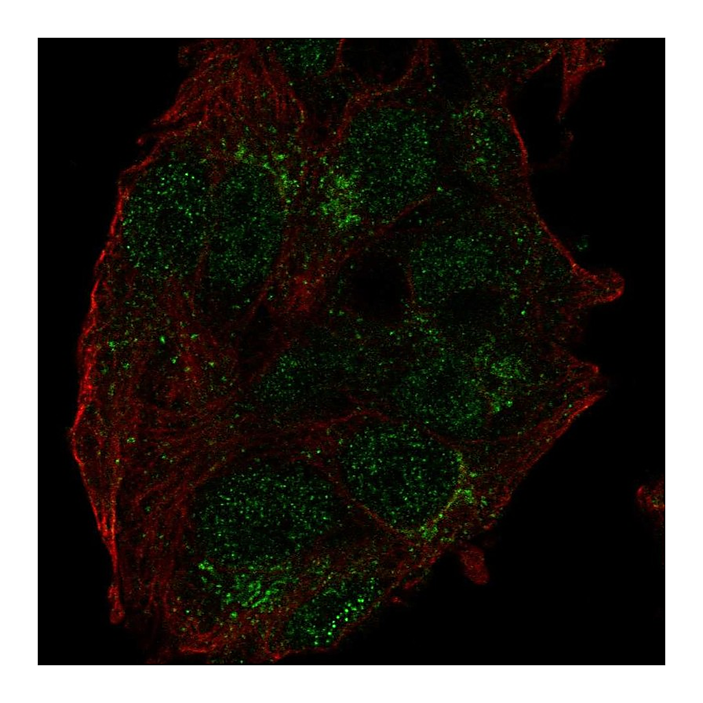 Atlas Antibodies Anti-USP27X Antibody