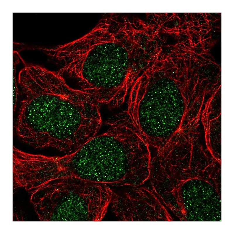 Atlas Antibodies Anti-USP3 Antibody