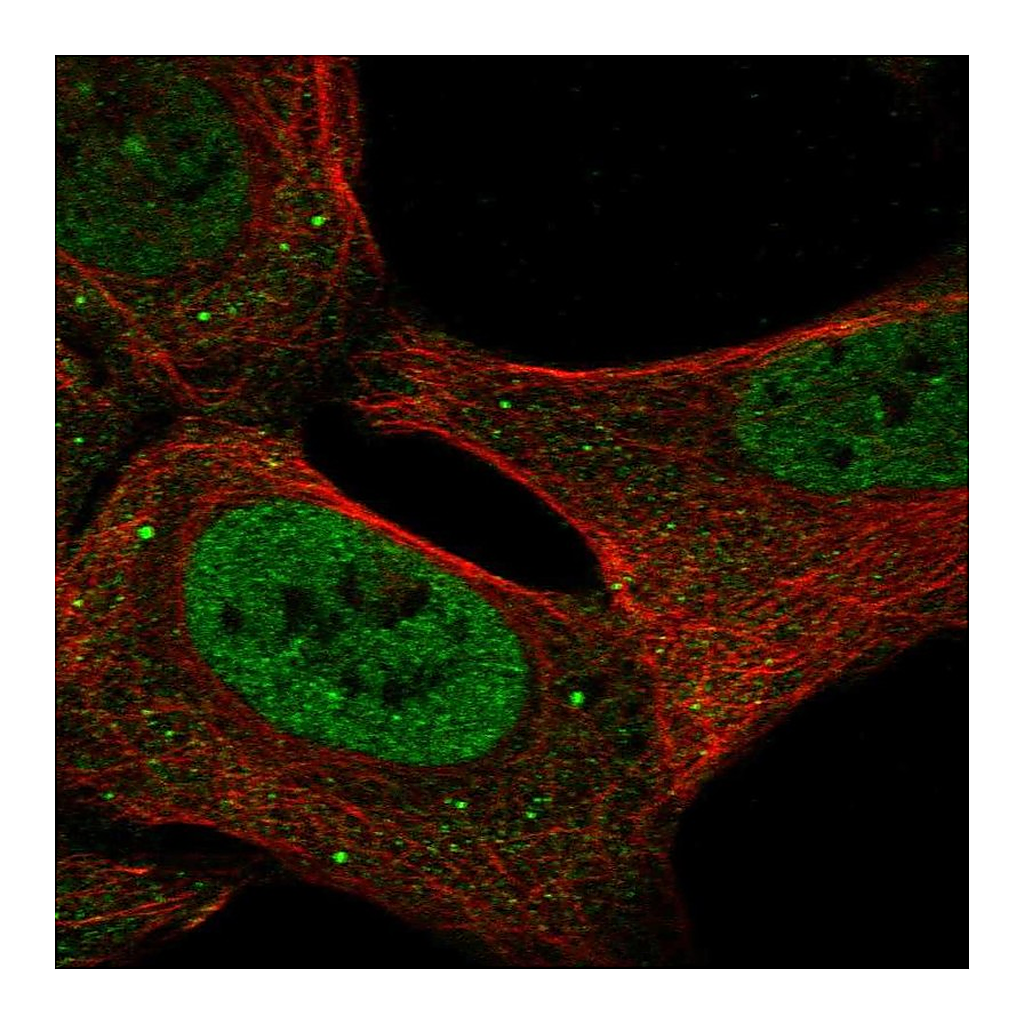 Atlas Antibodies Anti-USP3 Antibody
