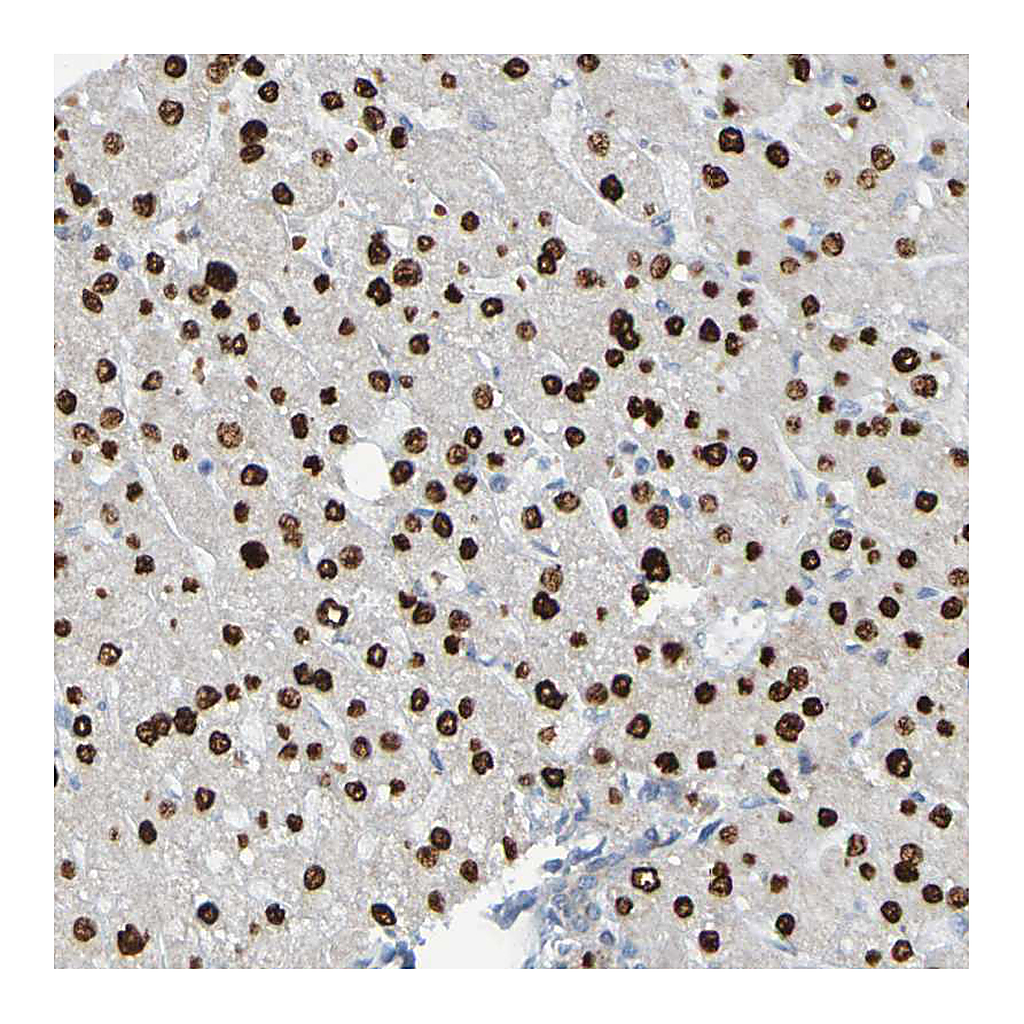 Atlas Antibodies Anti-USP36 Antibody