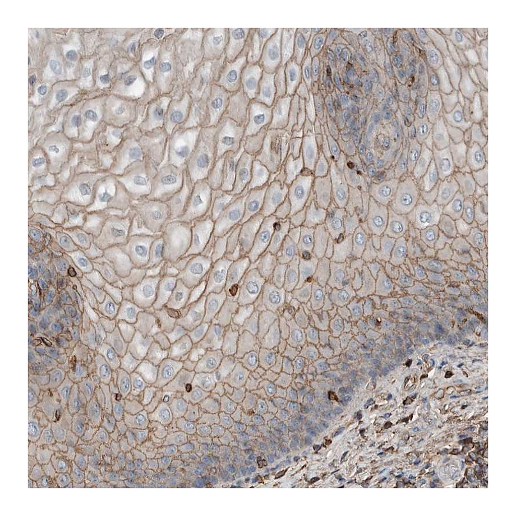 Atlas Antibodies Anti-USP34 Antibody