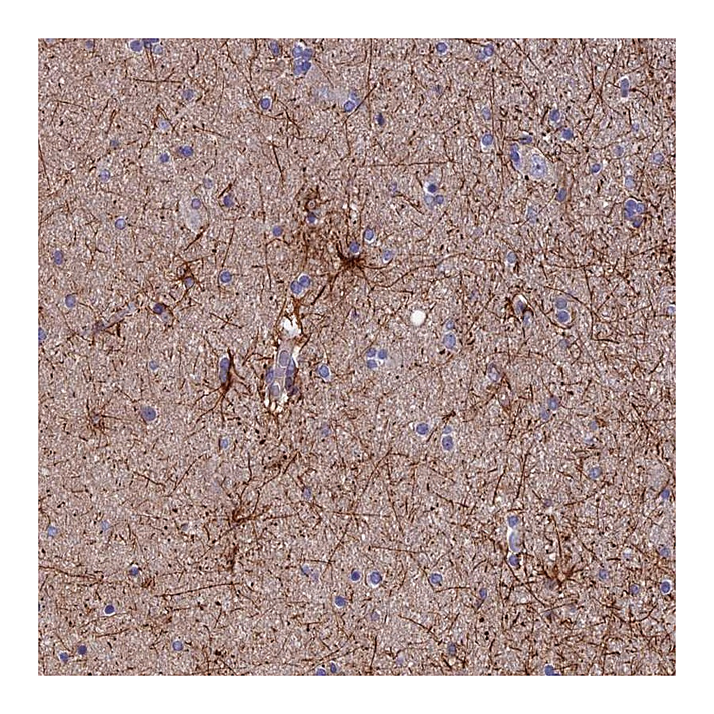 Atlas Antibodies Anti-USP37 Antibody
