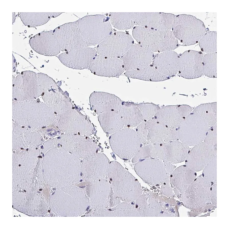 Atlas Antibodies Anti-USP35 Antibody