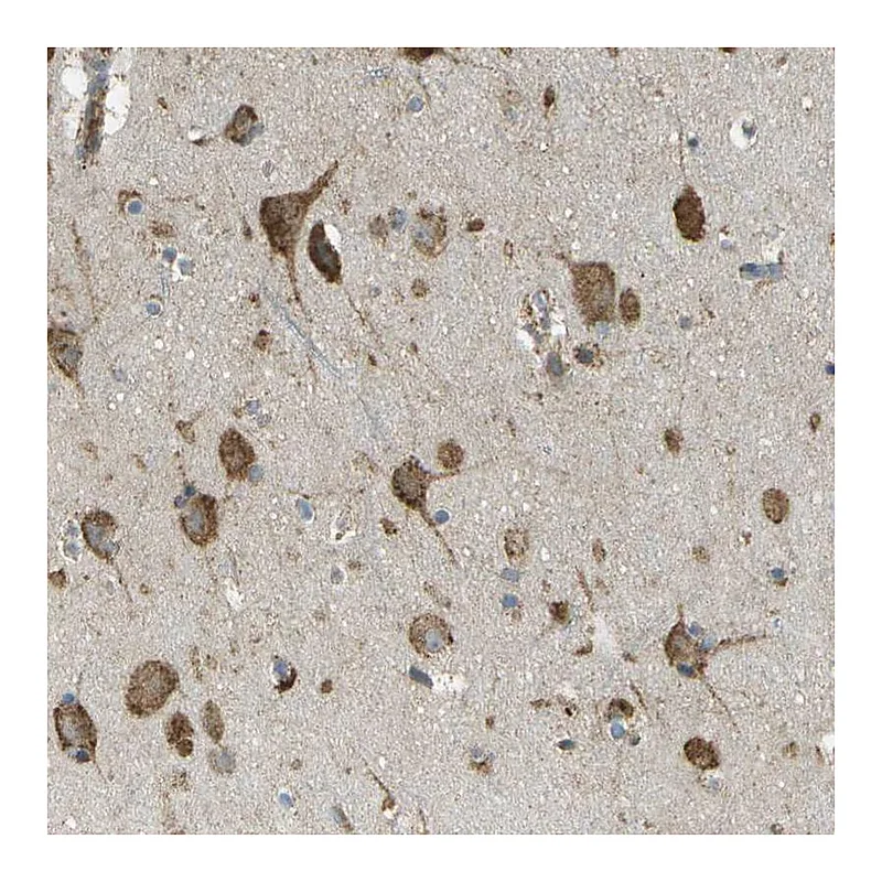 Atlas Antibodies Anti-USP30 Antibody