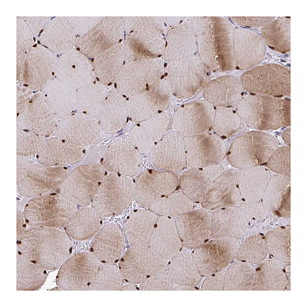 Atlas Antibodies Anti-USP35 Antibody