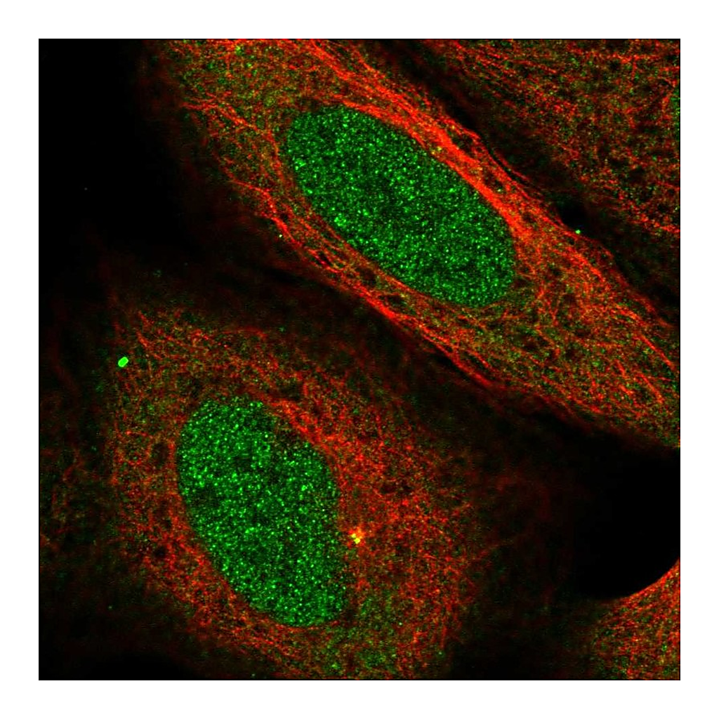 Atlas Antibodies Anti-USP38 Antibody