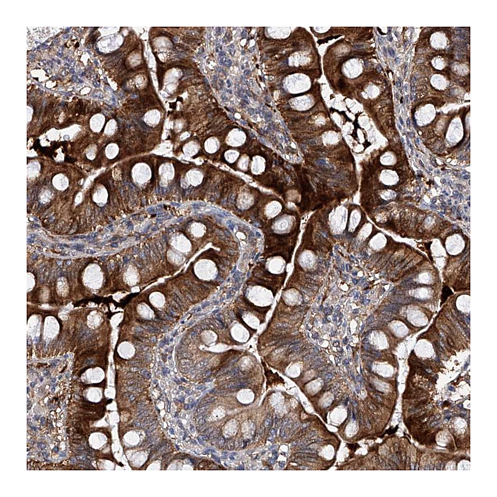 Atlas Antibodies Anti-USP45 Antibody