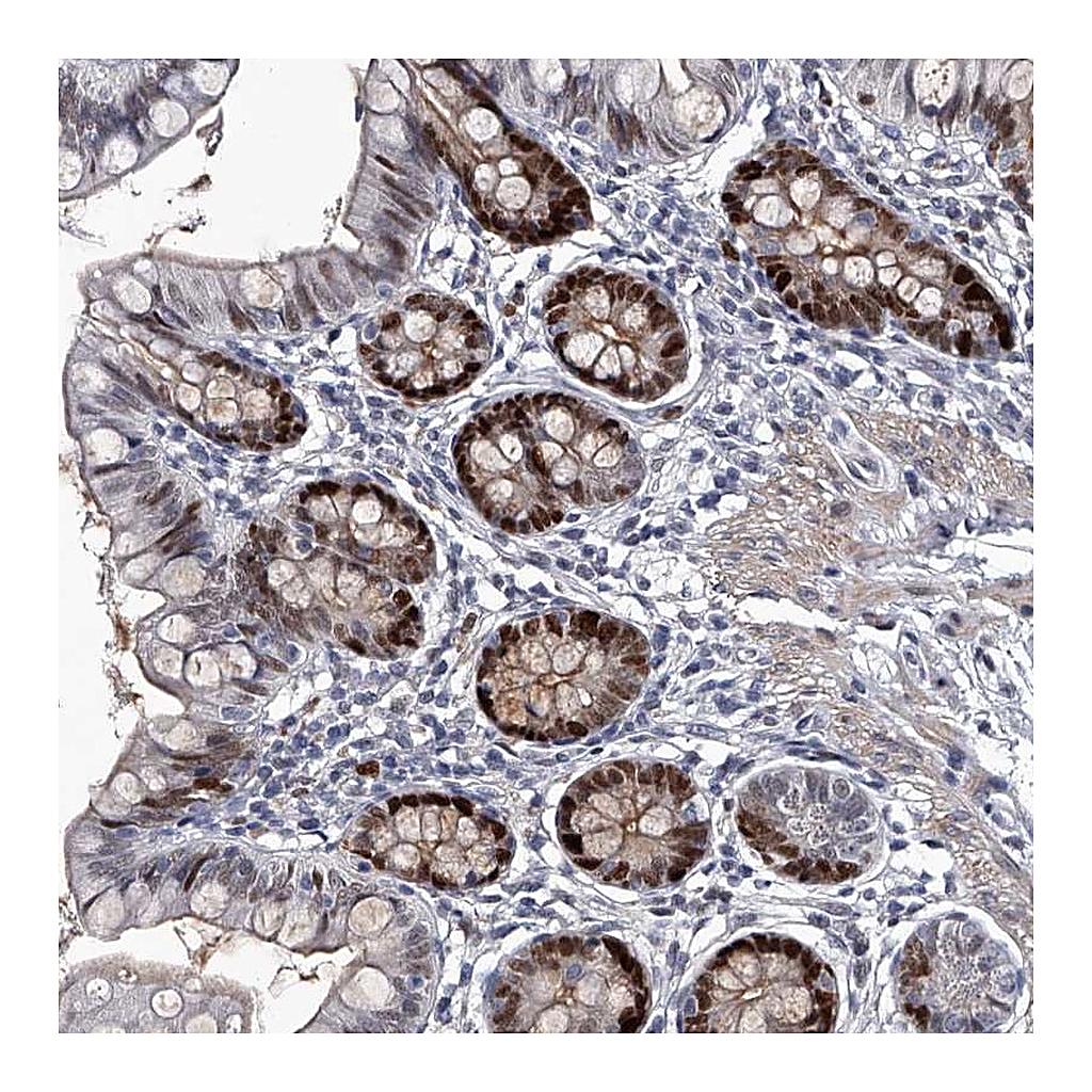 Atlas Antibodies Anti-USP45 Antibody