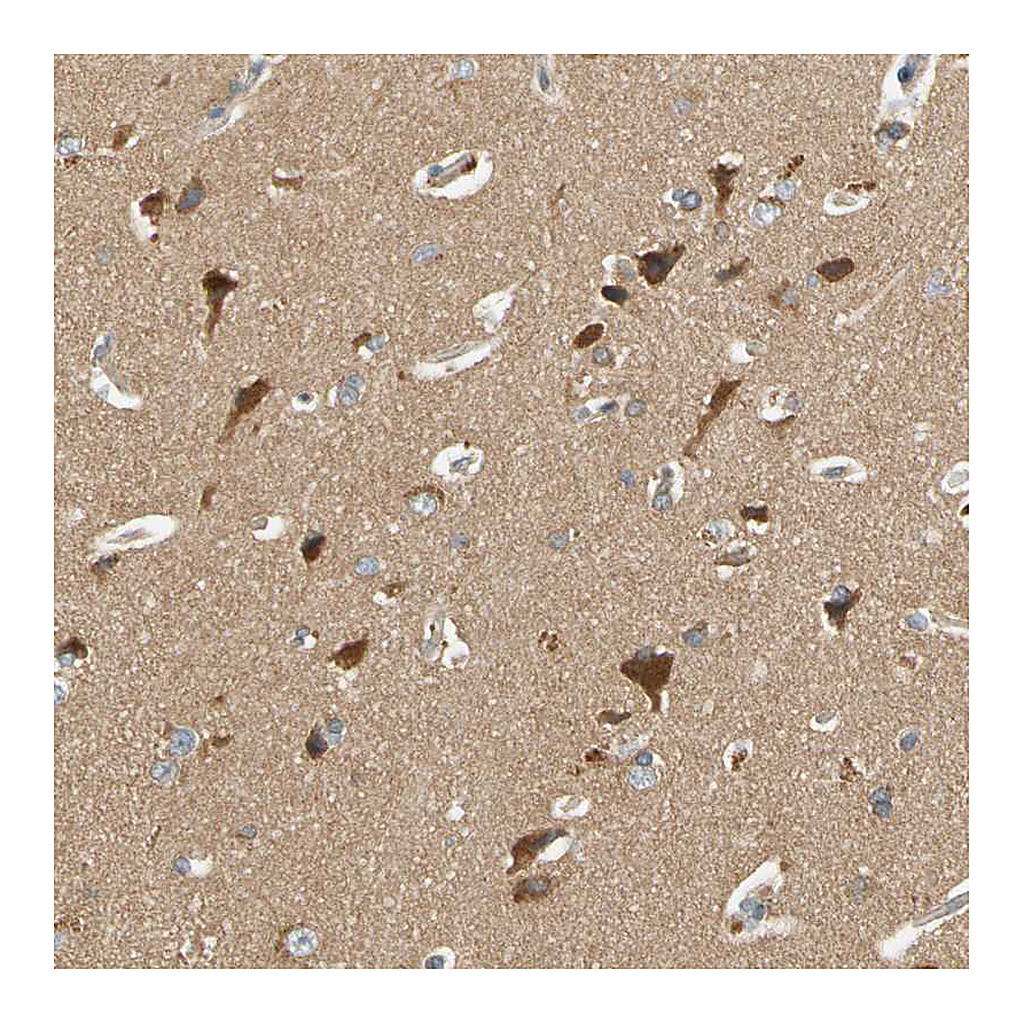 Atlas Antibodies Anti-USP46 Antibody