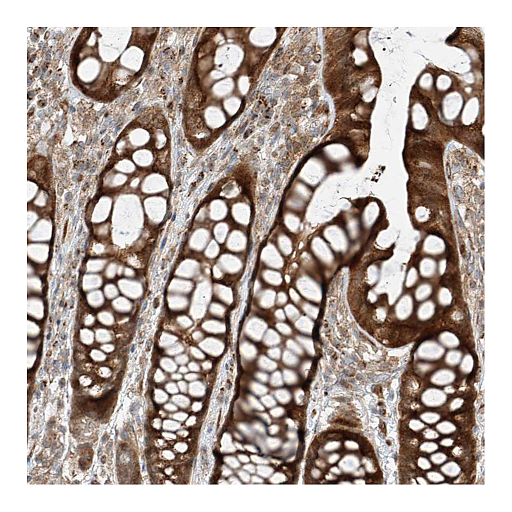 Atlas Antibodies Anti-USP48 Antibody