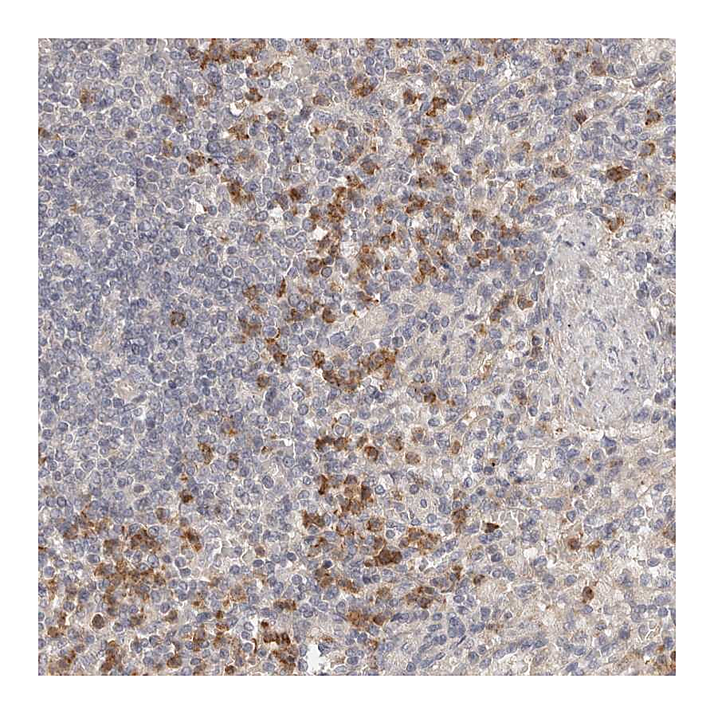 Atlas Antibodies Anti-USP49 Antibody