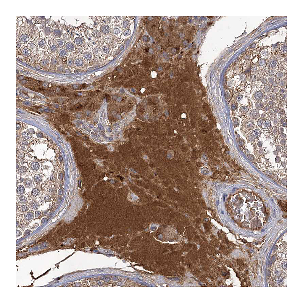Atlas Antibodies Anti-USP50 Antibody