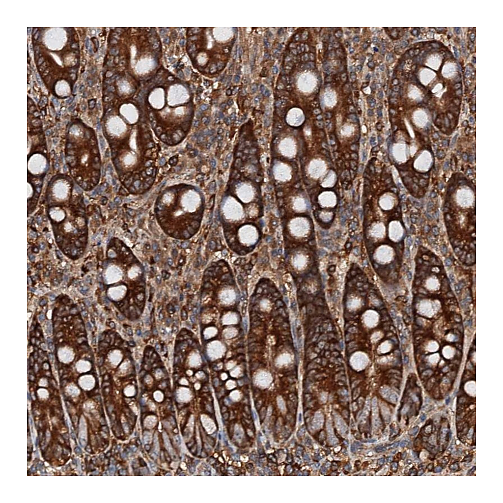 Atlas Antibodies Anti-USP6NL Antibody