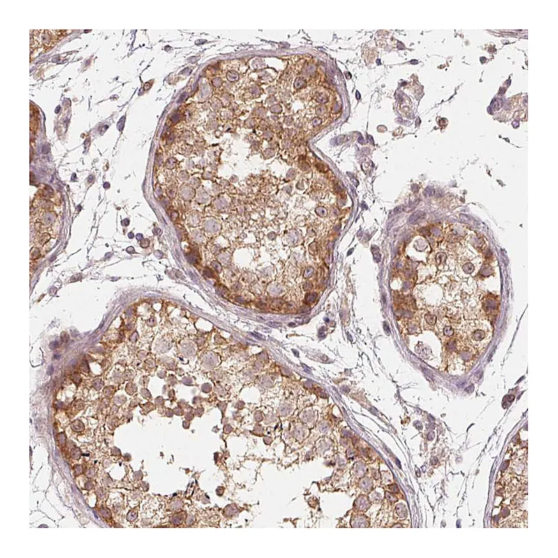 Atlas Antibodies Anti-USP8 Antibody