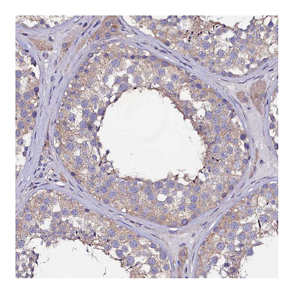 Atlas Antibodies Anti-USPL1 Antibody