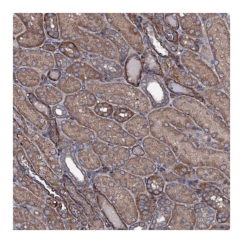 Atlas Antibodies Anti-USPL1 Antibody