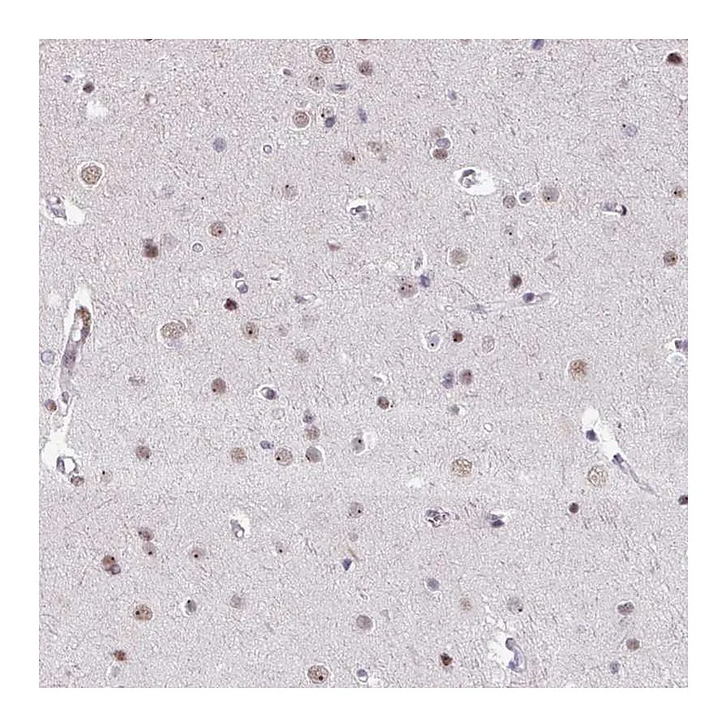 Atlas Antibodies Anti-UTP18 Antibody
