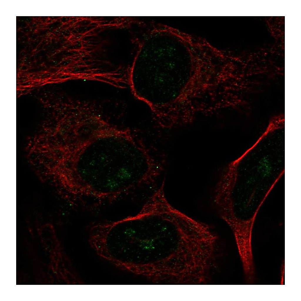 Atlas Antibodies Anti-UTP4 Antibody