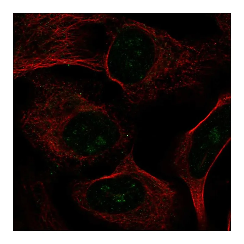 Atlas Antibodies Anti-UTP4 Antibody