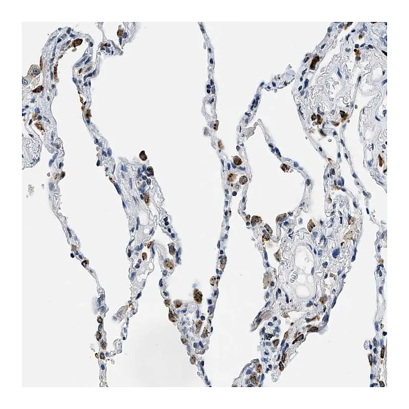 Atlas Antibodies Anti-UVRAG Antibody