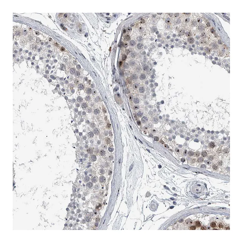Atlas Antibodies Anti-UTP6 Antibody