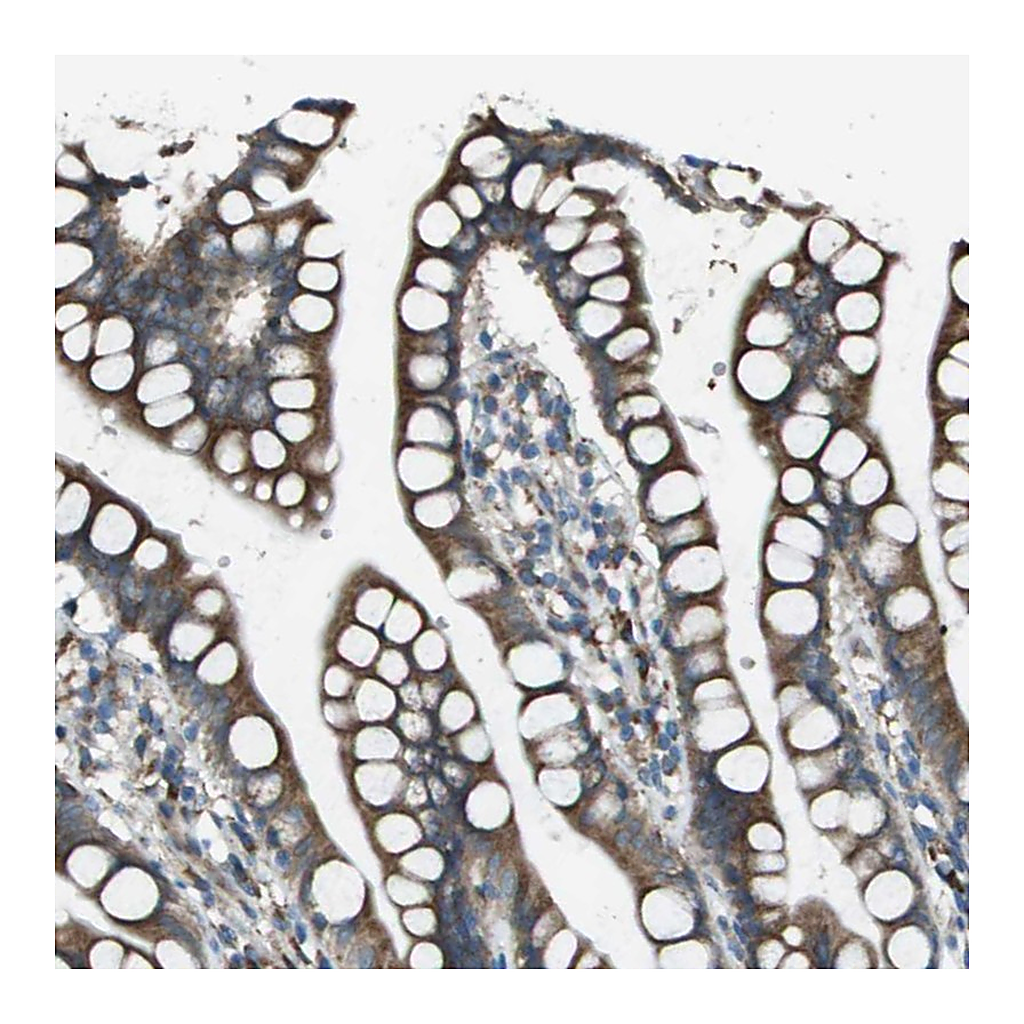 Atlas Antibodies Anti-UTS2 Antibody