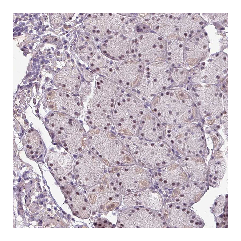 Atlas Antibodies Anti-UVSSA Antibody