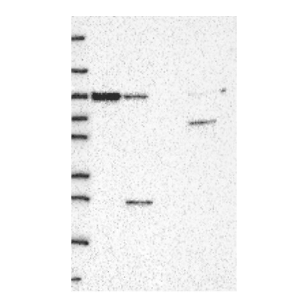Atlas Antibodies Anti-VAC14 Antibody